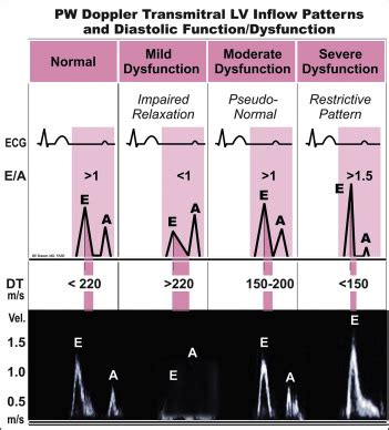 lv dysfunction meaning|is impaired lv relaxation dangerous.